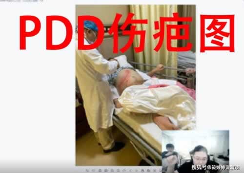 网络上网站出款通道风控不给提款怎么办?有人解决了吗?.内容开头语(图)